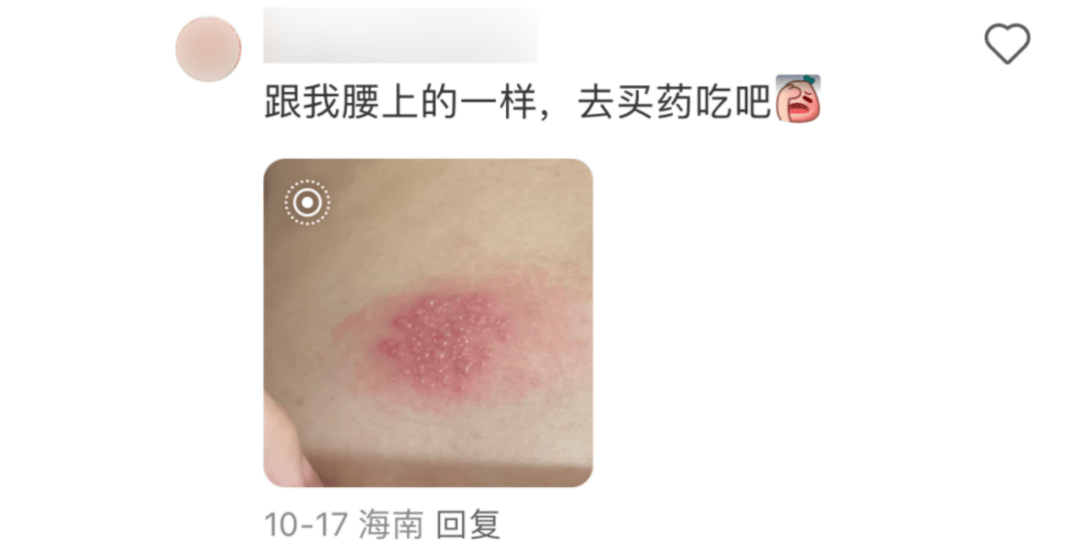 一旦感染终身携带<strong></p>
<p>屋里币</strong>!深圳疾控提醒:这4类人要注意