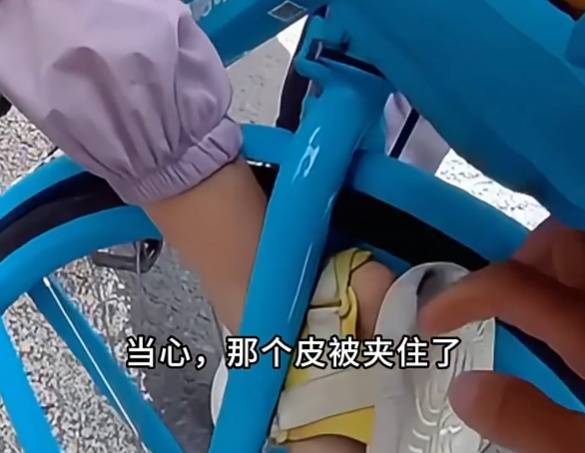 看着都疼<strong></p>
<p>黑币2001</strong>！上海街头一男子突然求助：10岁女儿被死死卡住！这个行为太危险→