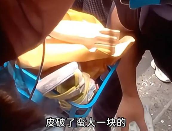 看着都疼<strong></p>
<p>黑币2001</strong>！上海街头一男子突然求助：10岁女儿被死死卡住！这个行为太危险→