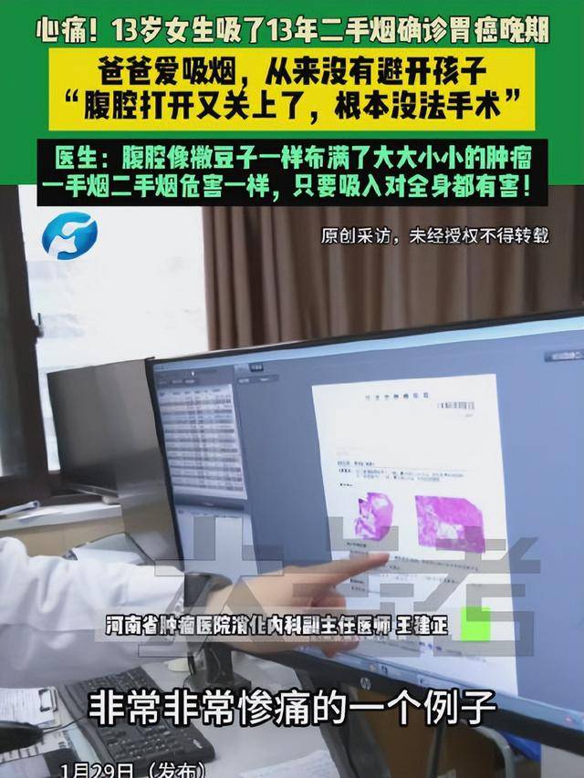 爸爸常年在家吸烟，13岁女儿吸13年二手烟腹腔内长满肿瘤